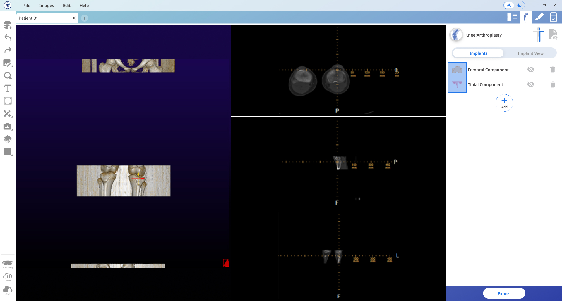 Implant Icons
